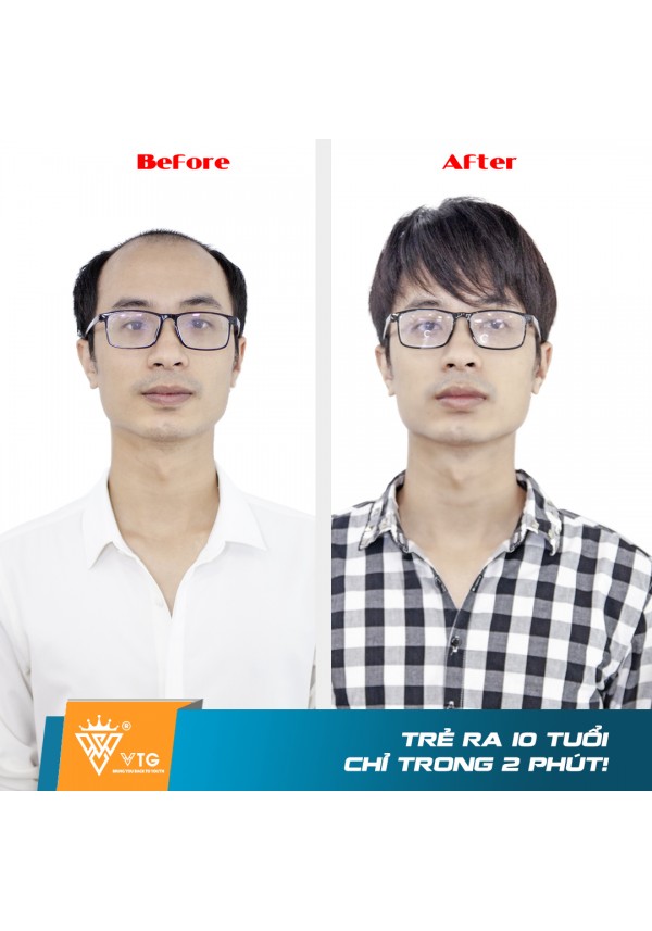 Tóc Giả Nam Trùm Nguyên Đầu - VTG C01